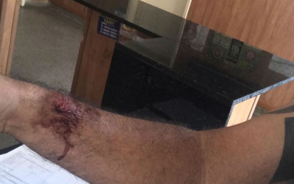 Motorista de aplicativo relata assédio e agressão após corrida durante carnaval — Foto: Arquivo pessoal