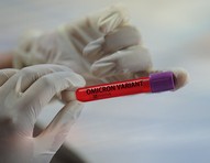 Homem não vacinado é a primeira morte oficial pela variante Ômicron nos EUA