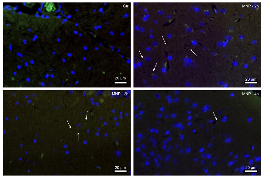 Imagens em imunofluorescência do cérebro de ratos. Grupo controle (Ctr) aparece em comparação com os roedores 2 e 4 horas após ingestão de partículas de micro e nanoplástico