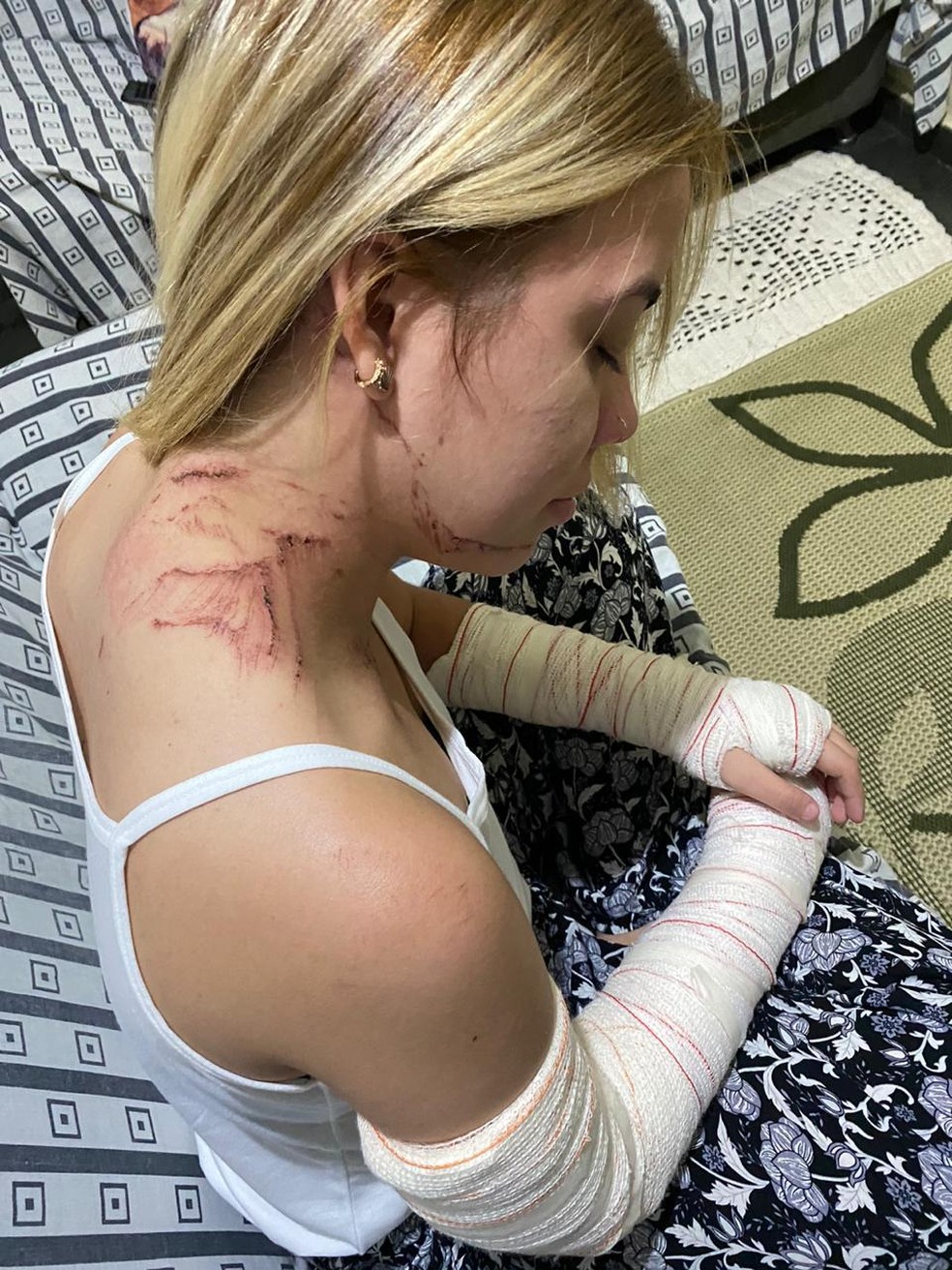 Braços também foram enfaixados após queda — Foto: Arquivo Pessoal