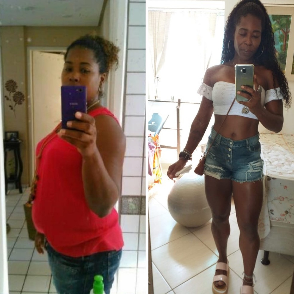Baiana Perde 29 Kg E Conta Que Medica Afirmou Que Ela Sempre Seria Obesa Emagreci Na Forca Do Odio Bahia G1