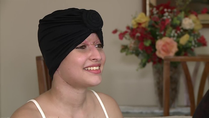 Débora deve passar por novas cirurgias em 2020 — Foto: Reprodução/TV Globo