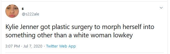 Comentário sobre possível cirurgia plástica de Kylie Jenner (Foto: Twitter)