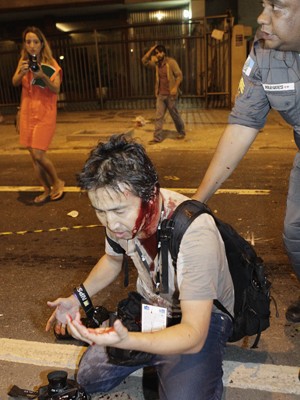 Fotógrafo de agência francesa ficou ferido (Foto: Uanderson Fernandes / Agência O Dia / Estadão Conteúdo)