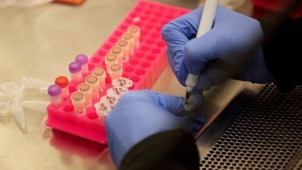 BBC - Estudos podem apontar que uma substância mata o vírus em laboratório, por exemplo, mas isso não significa que ela terá o mesmo efeito no corpo (Foto: Reuters via BBC)