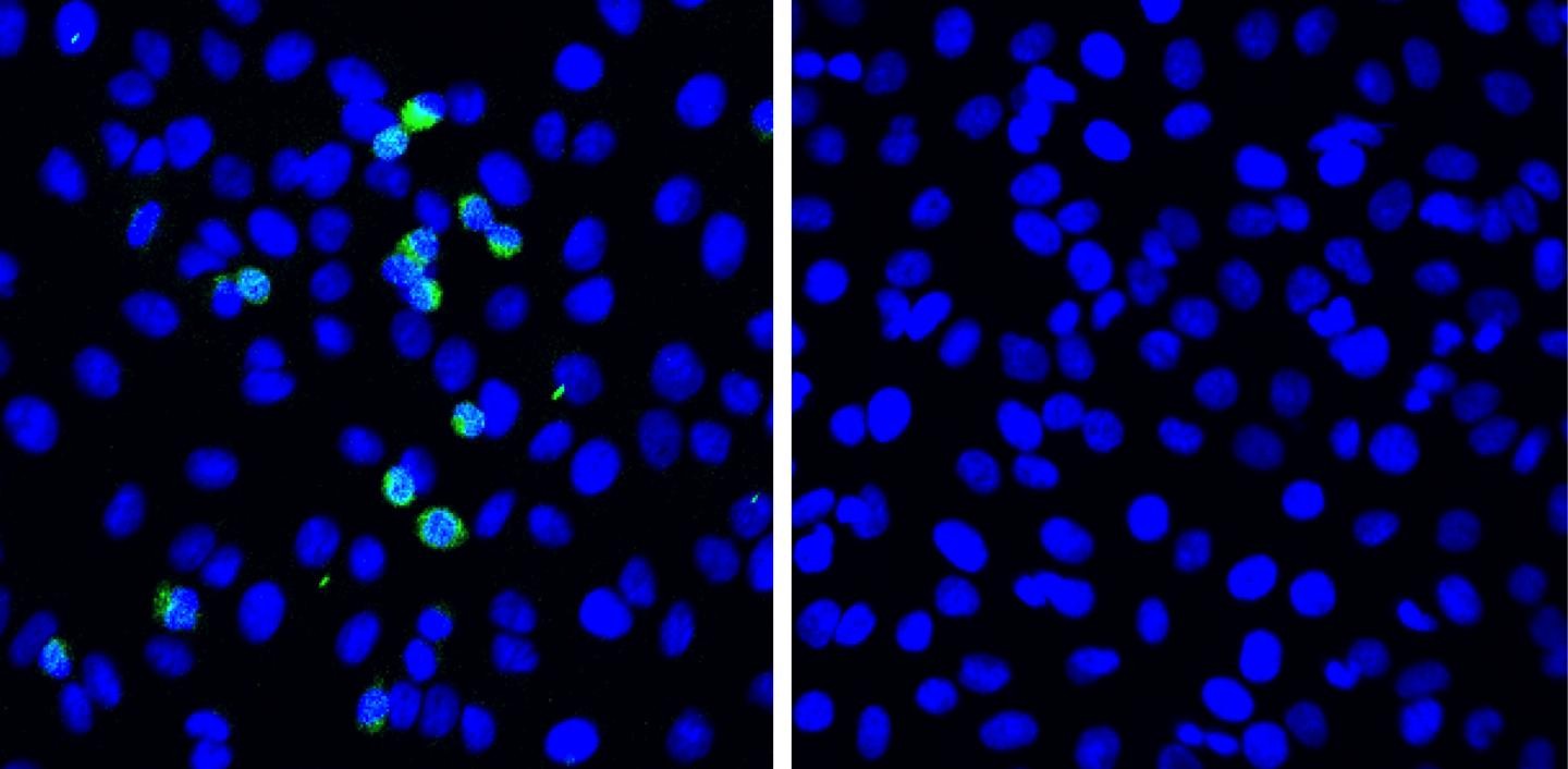Replicação do vírus Sars-CoV-2 sendo suprimida pela proteína RIG-I em células pulmonares (direita); células pulmonares que não expressam RIG-I (esquerda) são expostas ao coronavírus. Proteínas de pico viral (verde) são detectadas 5 dias após a exposição (Foto: Taisho Yamada, et al. Nature Immunology)