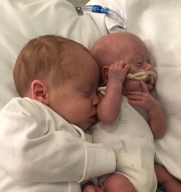 Bebê ajuda em recuperação de irmão gêmeo  (Foto: Reprodução Daily Mail/@miracletwins_plus3)