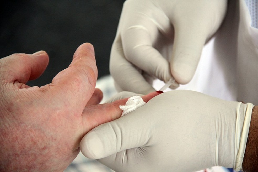 Uma Pessoa E Infectada Com Hiv A Cada 36 Horas No Tocantins Tocantins G1