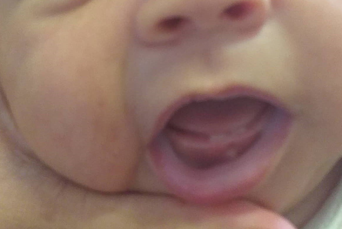 Por que em alguns bebês os dentes nascem precocemente? (Foto: Arquivo pessoal)