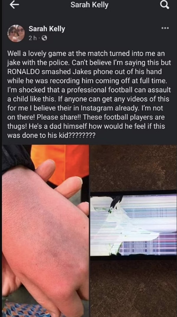 O post da mãe do adolescente agredido por Cristiano Ronaldo mostrando a mãe do filho lesionada e o celular quebrado (Foto: Instagram)