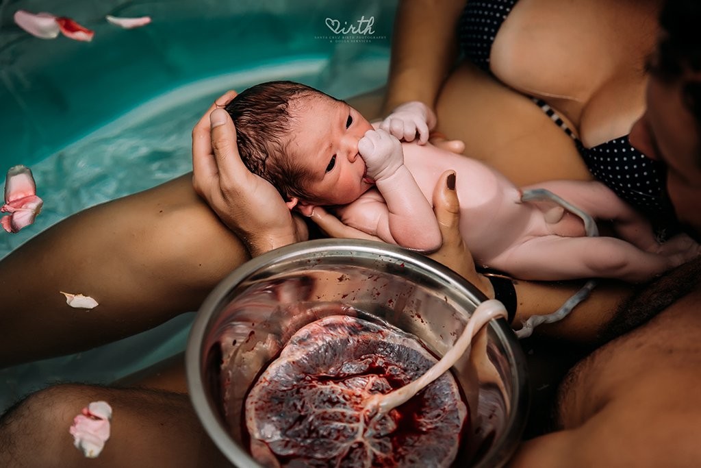 bebê coloca mão na boca no momento do parto (Foto: Paige Driscoll — Santa Cruz Birth Photography & Doula Services (United States) )
