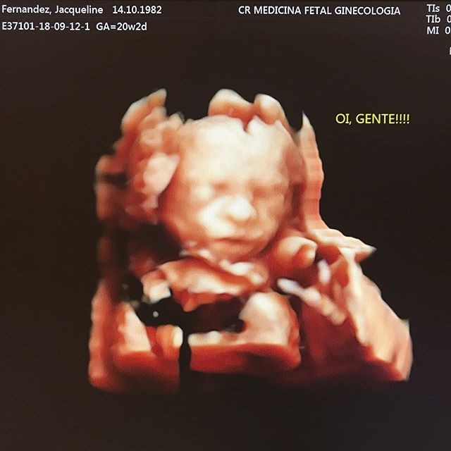 Ultrassonografia do primeiro filho de Marcio Kieling (Foto: Reprodução/Instagram)