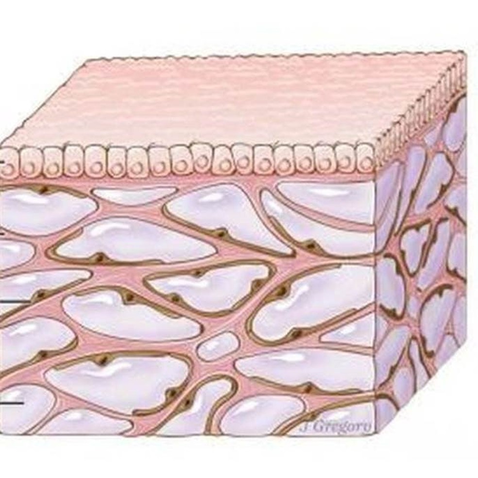 A camada de cima é a mucosa; as partes rosas são as estruturas de colágeno que criam as cavidades cheias de fluído (representado pela cor lilás) — Foto: Getty Images/BBC