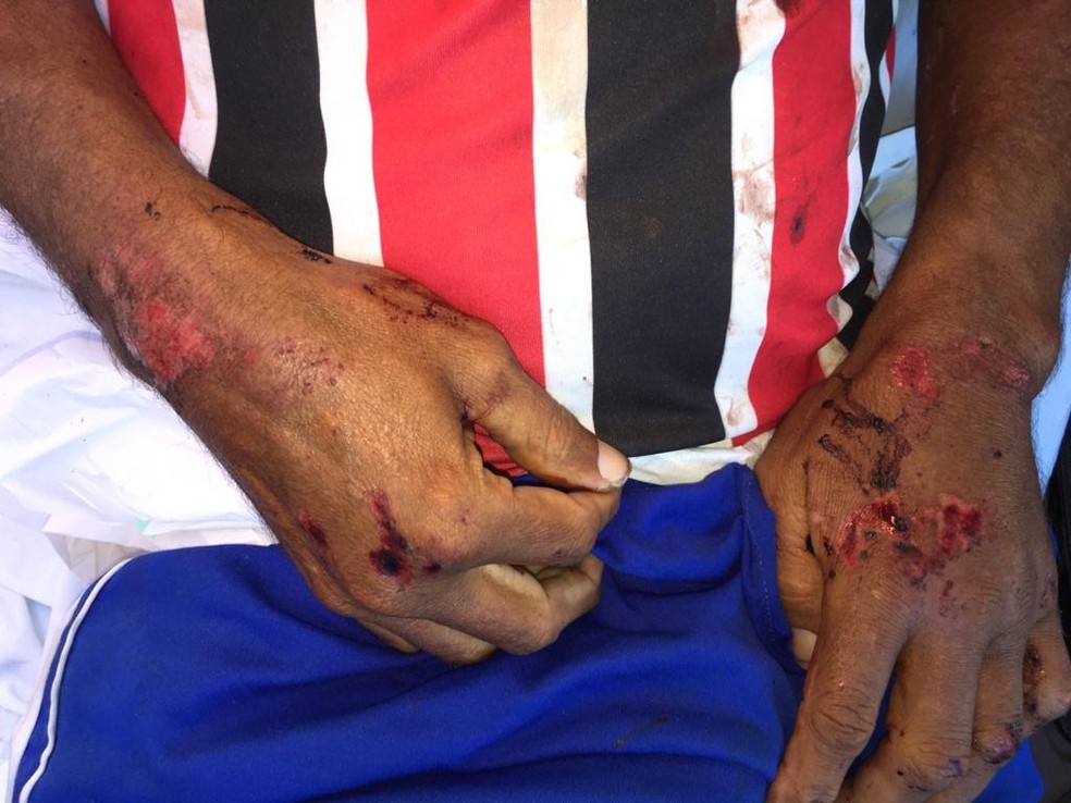 Cadeirante com ferimentos após ter sido atropelado em Maceió — Foto: Arquivo Pessoal