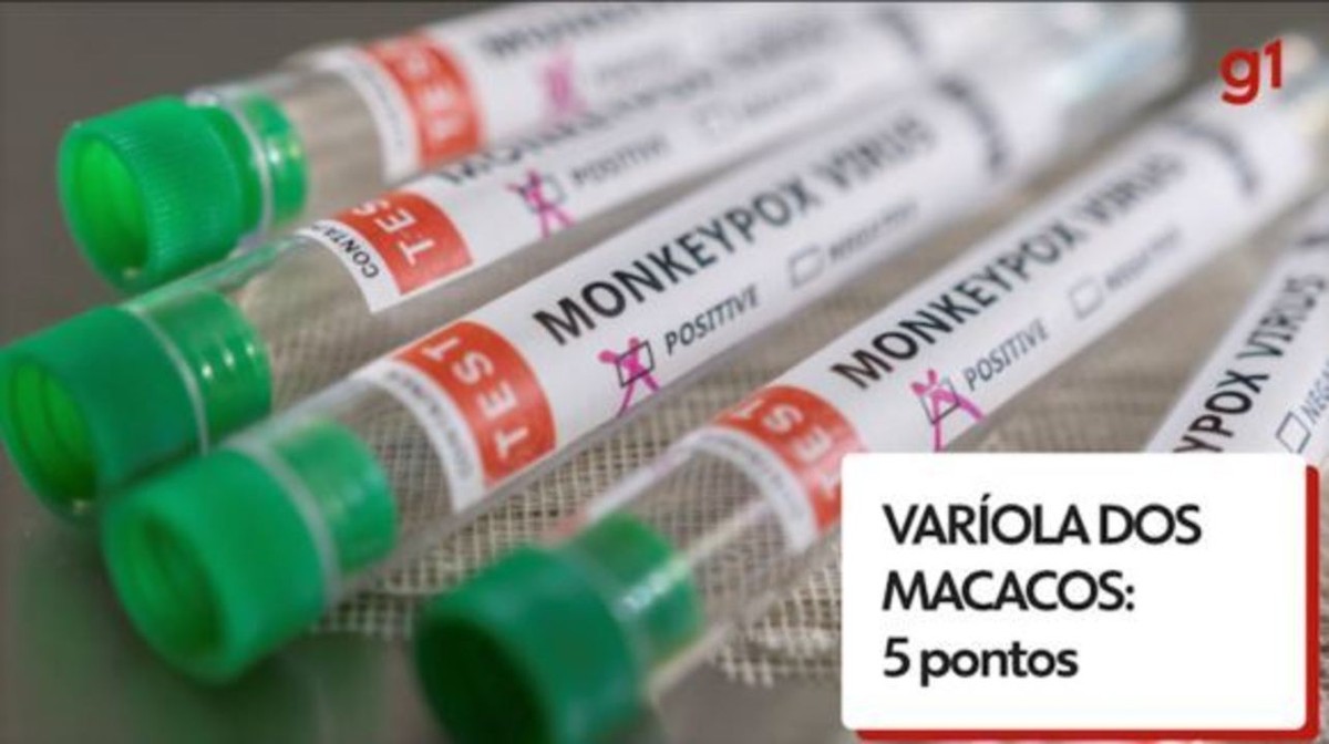 Mato Grosso do Sul notifica segundo caso suspeito de varíola dos macacos