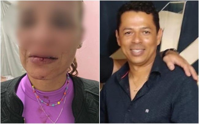 Secretrio de Comunicao de Morrinhos  preso suspeito de dar soco no rosto da esposa