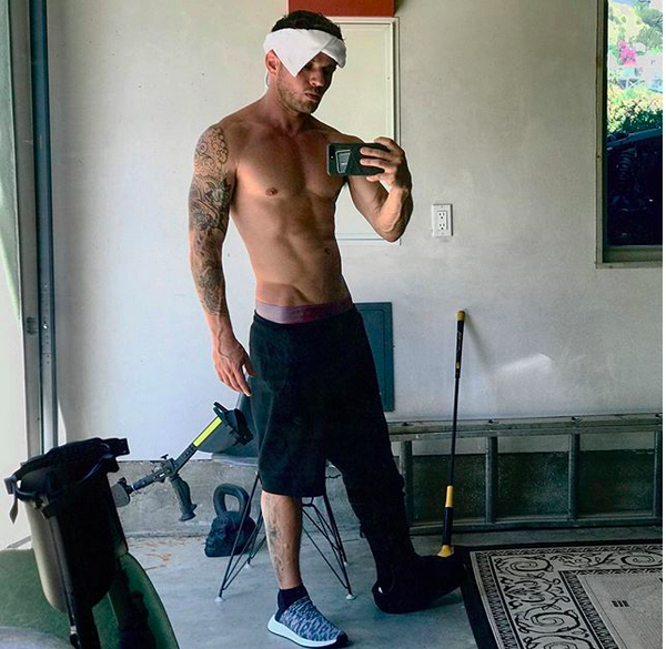 O ator Ryan Phillipe sem camisa em meioao tratamento de recuperação de sua perna quebrada (Foto: Instagram)