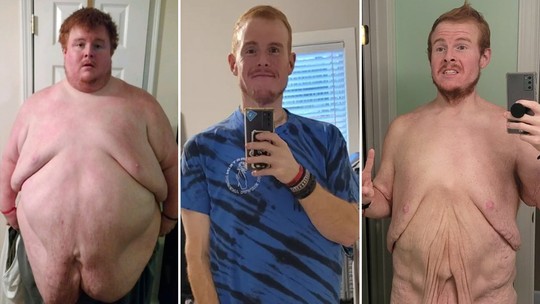 Astro de reality celebra perda de mais de 272 quilos com impressionantes fotos de antes e depois