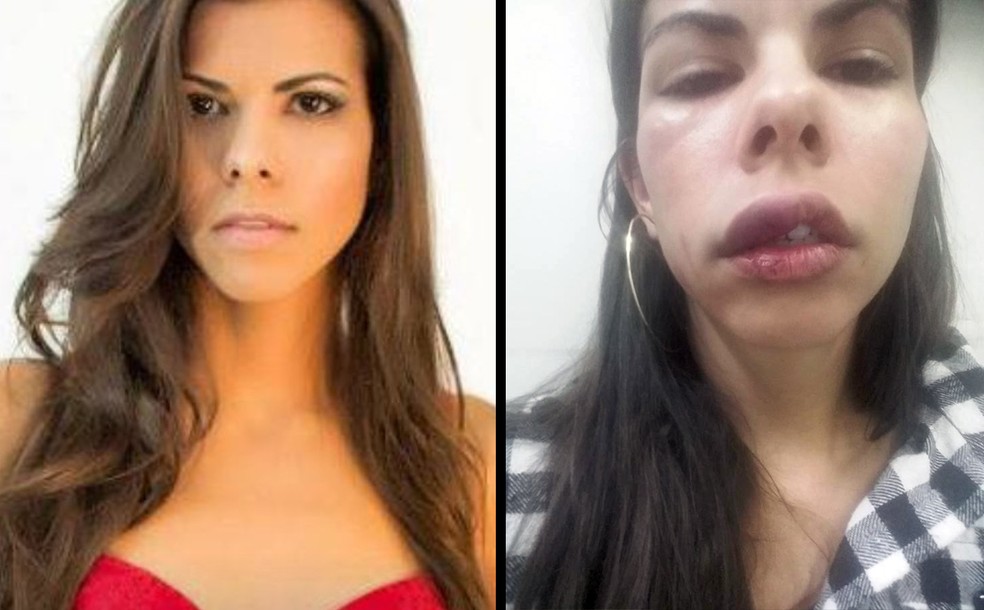 Vendedora publicou fotos do rosto machucado ap&oacute;s levar surra do namorado (Foto: Arquivo pessoal)