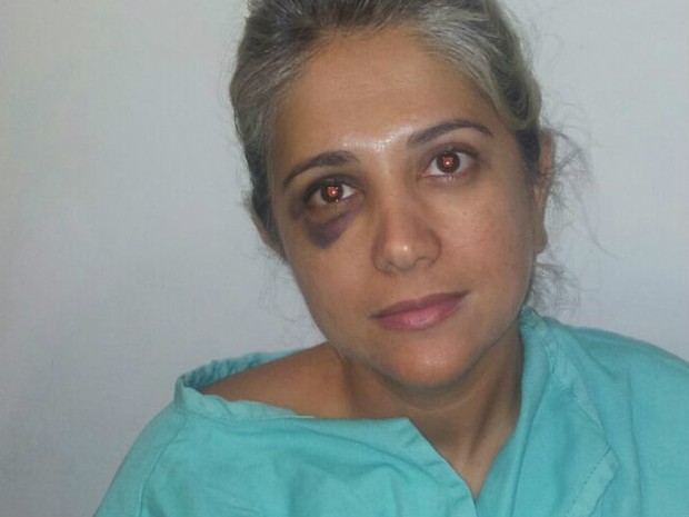 Mulher fraturou o rosto depois de acidente em banana boat (Foto: Reprodução/ TV Gazeta)