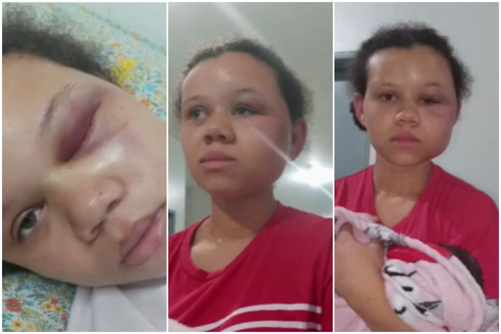 Jovem é agredida com socos e chutes pelo companheiro em Barra do Turvo, SP — Foto: Reprodução/TV Tribuna