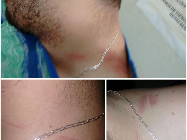 Homem é atingido por linha de cerol em Votorantim (Foto: Jorge Luís Barbosa/Arquivo Pessoal)