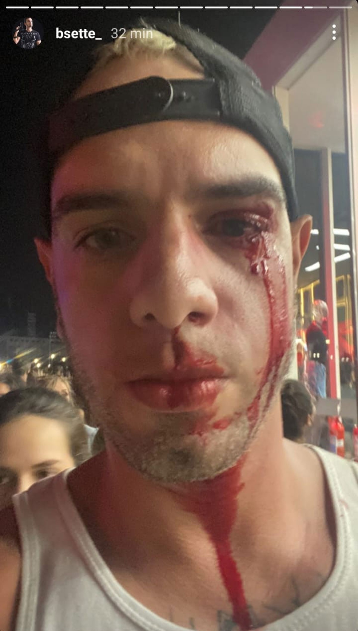 Un fotógrafo fue agredido después de chocar con una niña sentada en césped artificial en Roc, Rio |  Rock en Río 2022