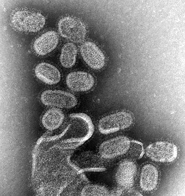 Vírus da gripe, ampliado 100 mil vezes.  (Foto: Wikipedia Commons)