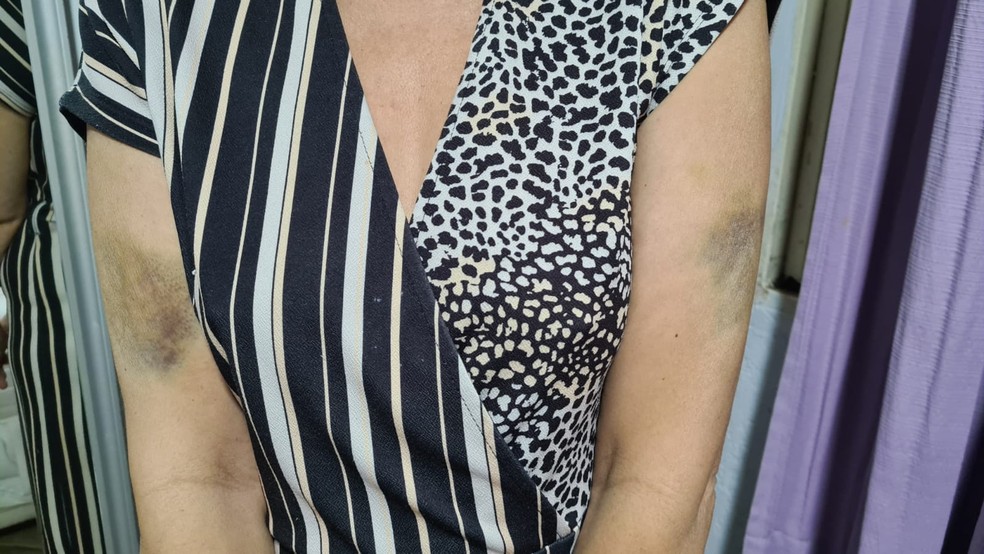 Mulher fica machucada após ser agredida por ex-companheiro, professor da UnB, em Brasília — Foto: Arquivo pessoal