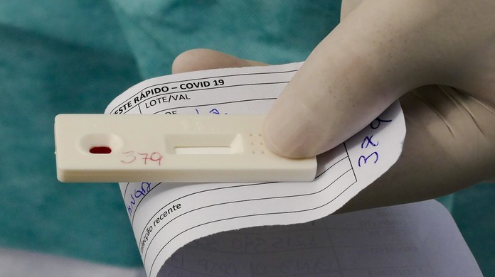 Coronavirus Entenda As Diferencas Entre O Teste Rapido E O Rt Pcr Distrito Federal G1