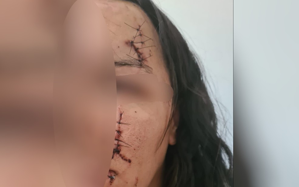 Mulher é agredida por não fazer programas a baixo custo em Alto Paraíso de Goiás — Foto:  Reprodução/Polícia Civil