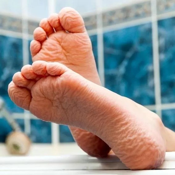 Pele dos nossos pés e mãos enruga-se e murcha durante banho, enquanto outras partes do corpo não passam pela mesma transformação (Foto: Alamy via BBC News)