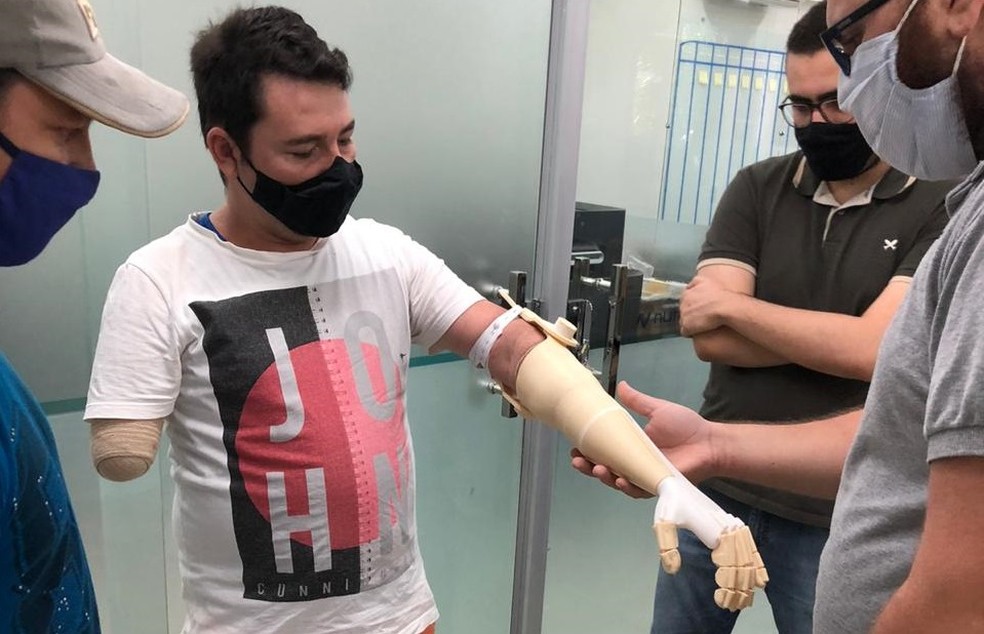 UEPB desenvolve protése de membro superior para homem que perdeu os dois braços em um acidente de trabalho — Foto: Leonardo Alves/UEPB
