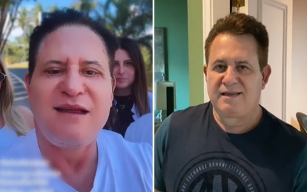 esquerda, Marrone depois da cirurgia facial;  direita, o cantor antes do procedimento  Foto: Reproduo/Redes sociais
