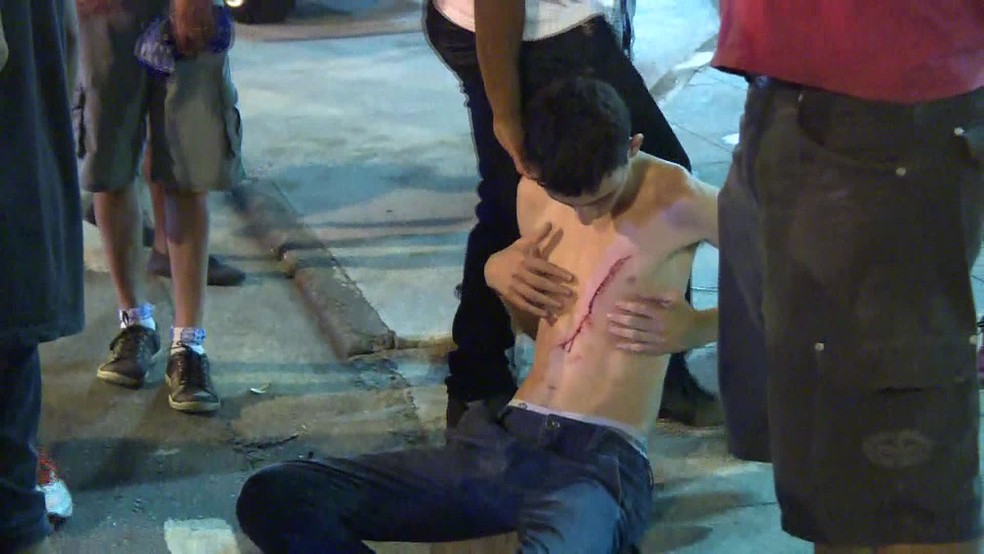 Jovem ficou ferido no peito (Foto: Robson Coutinho/Reprodução/GloboNews)