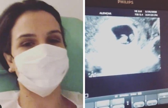 Kyra Gracie mostra momento do primeiro ultrassom de seu terceiro filho (Foto: Reprodução/Instagram)