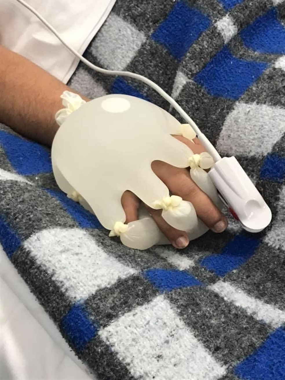 Técnica da 'mãozinha', criada por enfermeira para dar conforto a pacientes com viraliza: 'Foi momento de desespero' | Rio de | G1