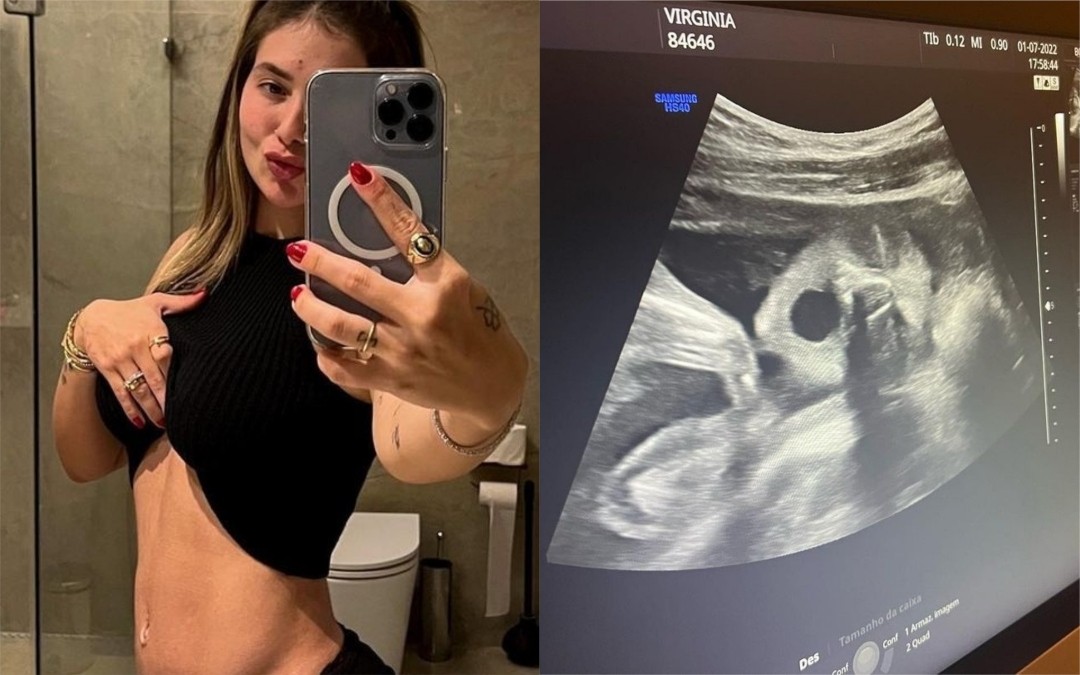 Virginia Fonseca exibe novo ultrassom (Foto: Reprodução/Instagram)