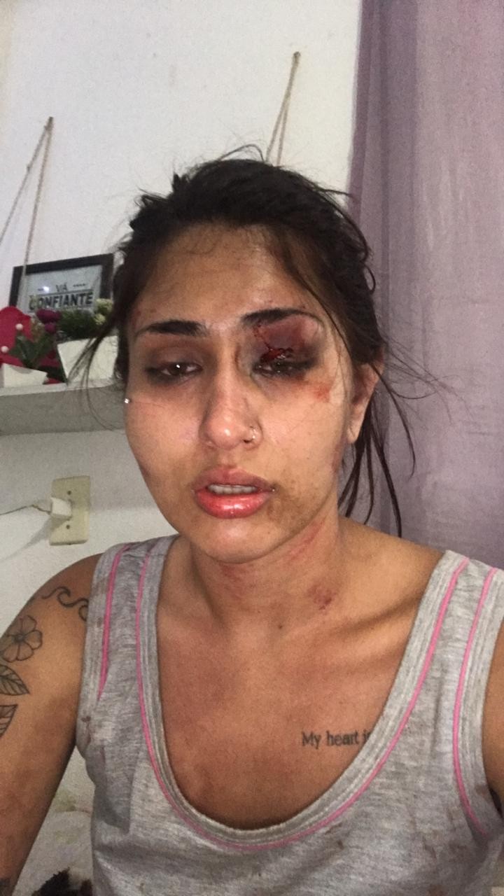 Nalu Costa foi agredida pelo namorado  (Foto: Arquivo Pessoal )