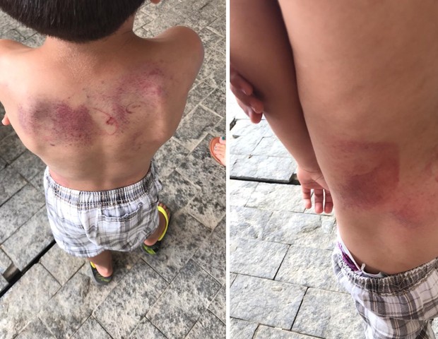 Marcas no corpo da criança de 5 anos impressiona (Foto: Conselho Tutelar de Balneário Camboriú)