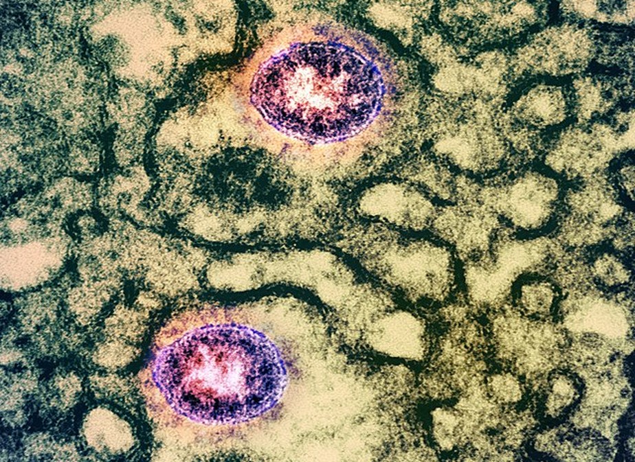 Imagem de partículas do vírus SARS-CoV-2 Omicron (roxo) replicando dentro do citoplasma de uma célula ( verde)