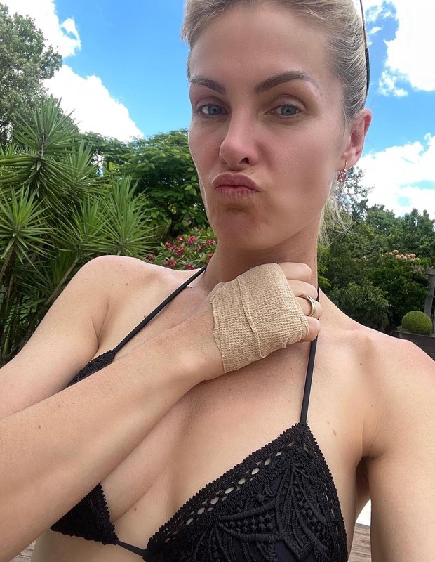 Ana Hickmann se machuca colhendo mangas (Foto: Reprodução/Instagram)