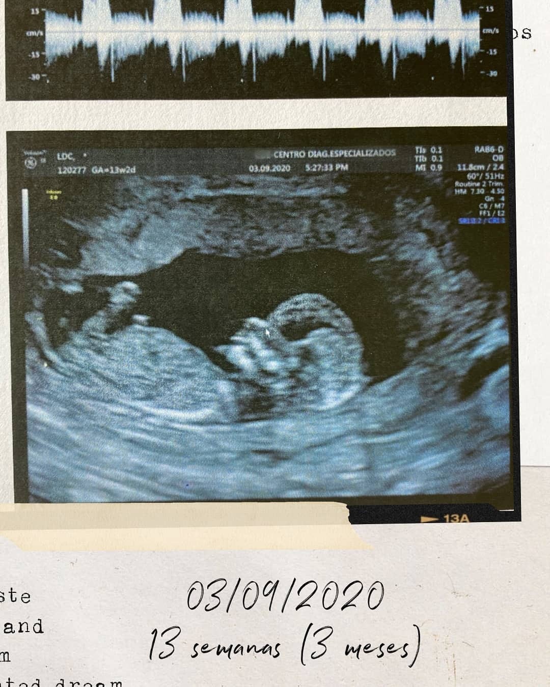 Lucas Lucco mostra ultrassonografia do filho quando bebê tinha 13 semanasi (Foto: Reprodução Instagram)