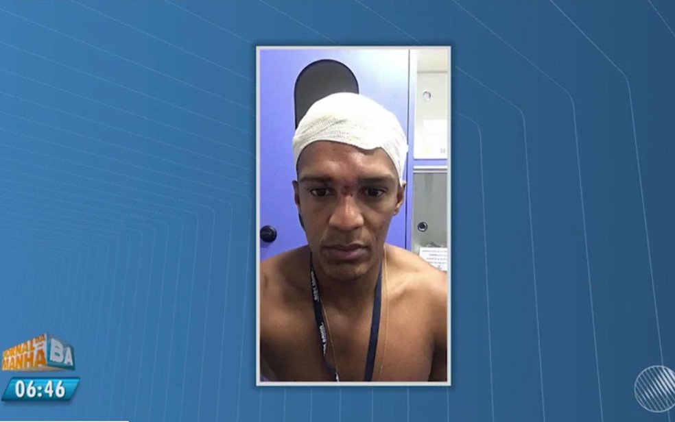 Betto Júnior teve cortes na cabeça ao ser agredido (Foto: Reprodução/ TV Bahia)