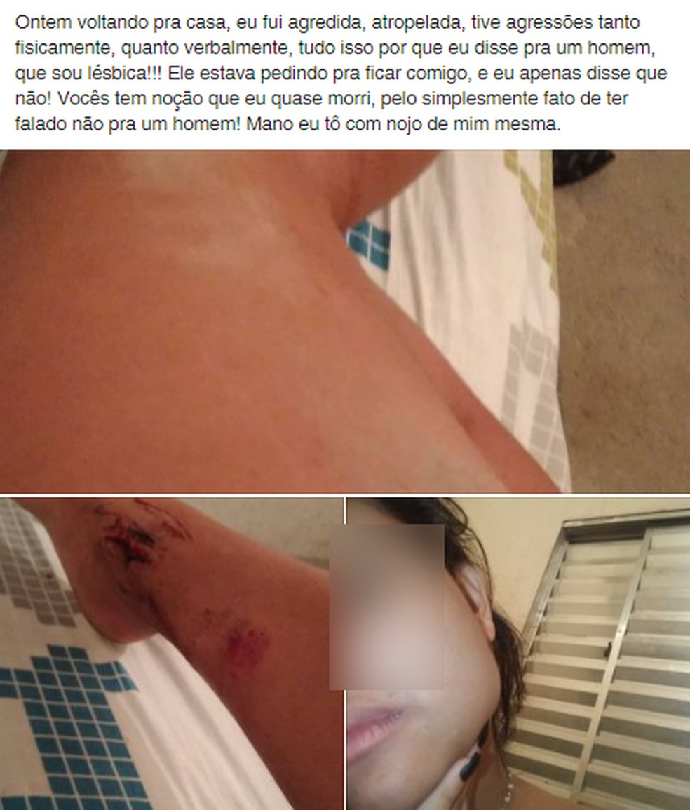 Jovem fez postagem nas redes sociais sobre o ocorrido  — Foto: Reprodução/Facebook