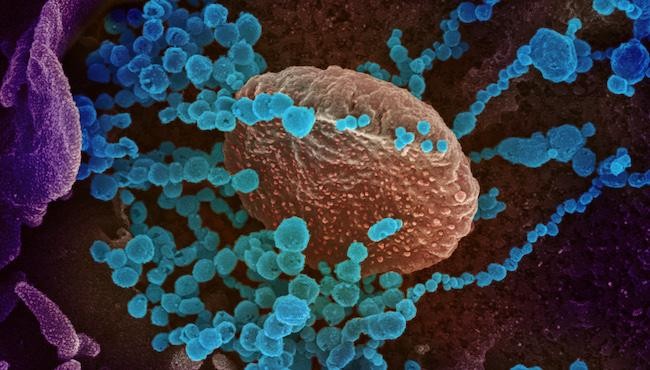 Sars-CoV-2 (bolinhas azuis) emergindo da superfície de células cultivadas em laboratório. (Foto: NIAID)