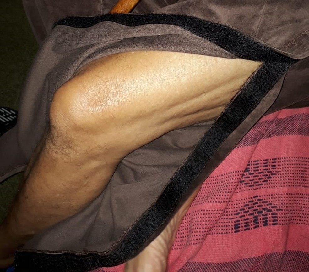 Funcionamento da calça masculina; Uberlândia; Roupa Alzheimer  — Foto: Carolina Mendonça Duarte/ Divulgação