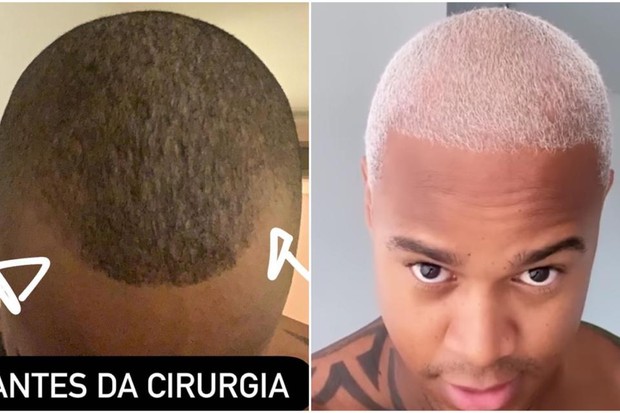 Léo Santana mostrando como seu cabelo era antes e atualmente (Foto: Reprodução/ Instagram)