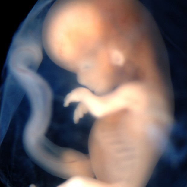 Bebê de 3 pais tem mitocôndrias de doadora, DNA da mãe e do pai (Foto: Flickr/lunar caustic/Creative Commons)
