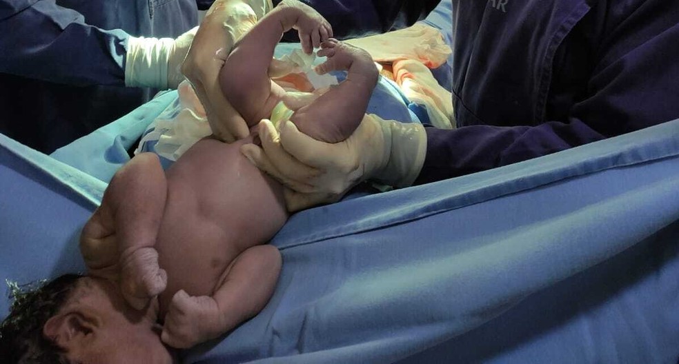 Bebê nasce com pezinhos tortos formando um coração em RO — Foto: Tamara Rocha/Arquivo Pessoal